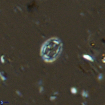 Prediscosphaera spinosa VR 14717
