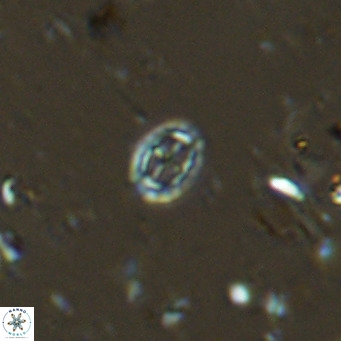 Prediscosphaera spinosa VR 14717
