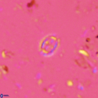 Prediscosphaera spinosa VR 14718
