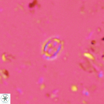 Prediscosphaera spinosa VR 14718