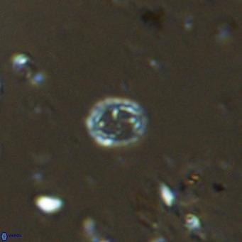 Prediscosphaera spinosa VR 14719
