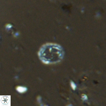 Prediscosphaera spinosa VR 14719