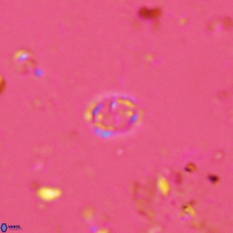 Prediscosphaera spinosa VR 14720