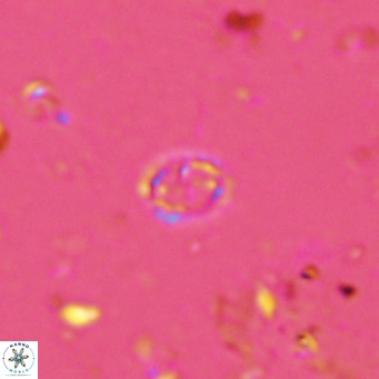 Prediscosphaera spinosa VR 14720