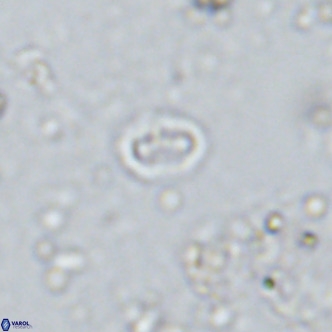 Prediscosphaera spinosa VR 14721