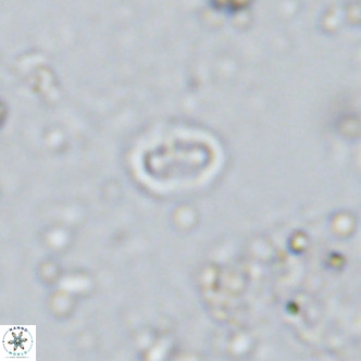 Prediscosphaera spinosa VR 14721