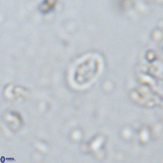 Prediscosphaera spinosa VR 14723