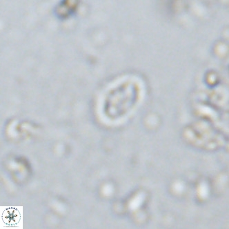 Prediscosphaera spinosa VR 14723