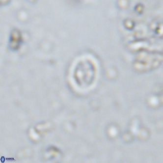 Prediscosphaera spinosa VR 14724