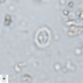 Prediscosphaera spinosa VR 14724