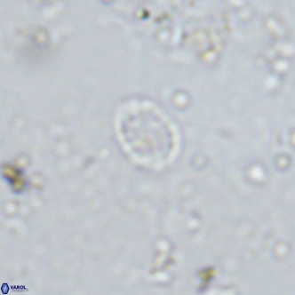 Prediscosphaera spinosa VR 14725