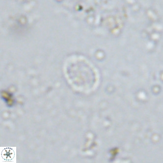 Prediscosphaera spinosa VR 14725