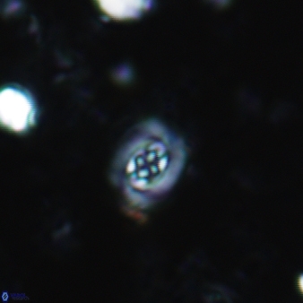 Prediscosphaera stoveri 773