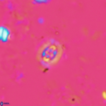 Prediscosphaera stoveri 774
