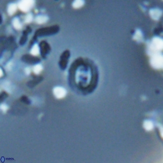 Prediscosphaera stoveri 15828