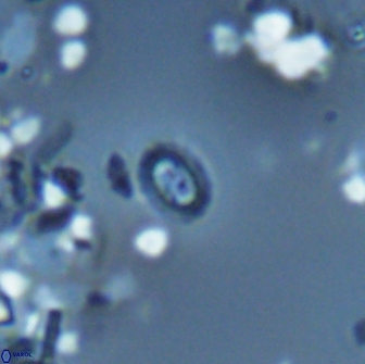 Prediscosphaera stoveri 15829