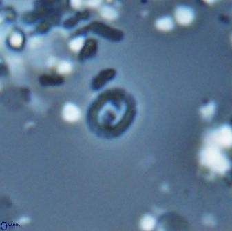 Prediscosphaera stoveri 15830