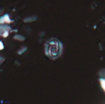 Prediscosphaera stoveri 15832