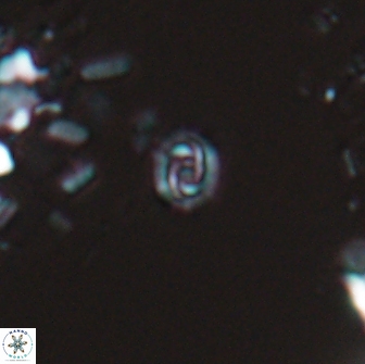 Prediscosphaera stoveri 15832