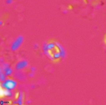 Prediscosphaera stoveri 15835