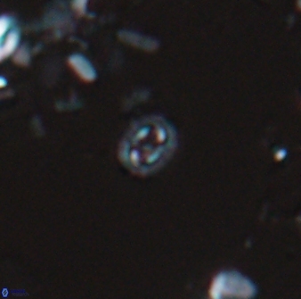 Prediscosphaera stoveri 15836
