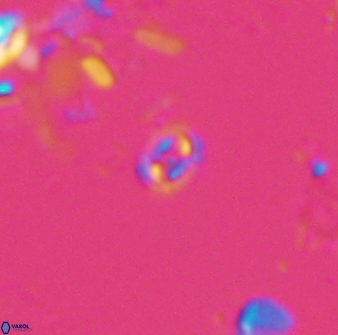 Prediscosphaera stoveri 15837