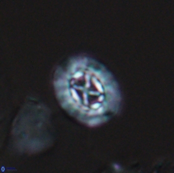 Prediscosphaera rzehaki 10084