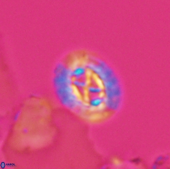 Prediscosphaera rzehaki 10085