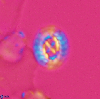 Prediscosphaera rzehaki 10087