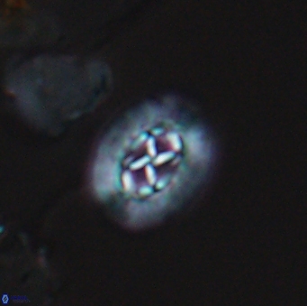 Prediscosphaera rzehaki 10088