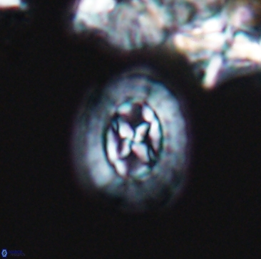Prediscosphaera rzehaki 12210