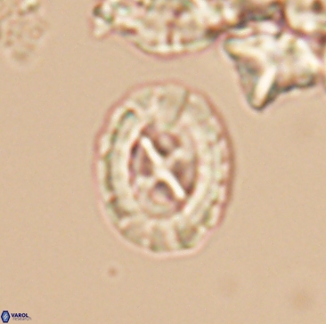 Prediscosphaera rzehaki 12213
