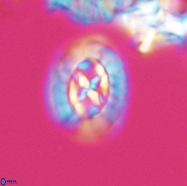 Prediscosphaera rzehaki 12214