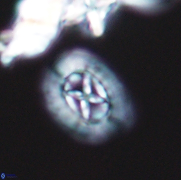 Prediscosphaera rzehaki 12216
