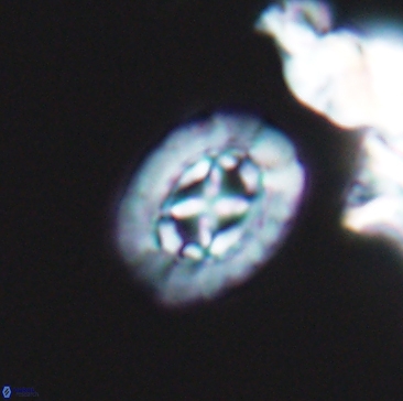 Prediscosphaera rzehaki 12217