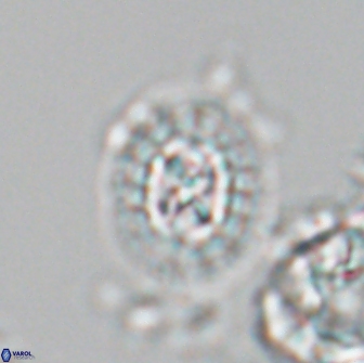 Prediscosphaera rzhaqii 18195