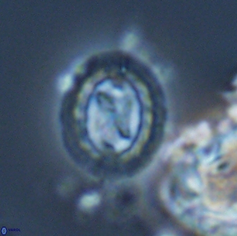 Prediscosphaera rzhaqii 18196