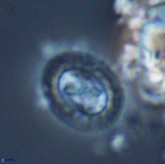 Prediscosphaera rzhaqii 18197