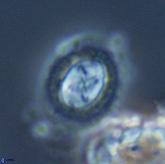 Prediscosphaera rzhaqii 18199