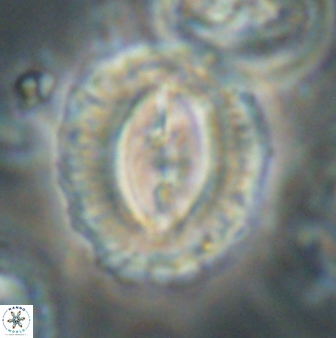 Prinsius amplus 63862