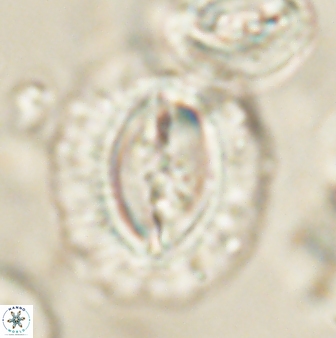 Prinsius amplus 63864