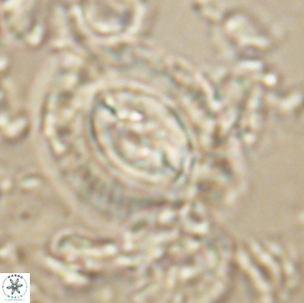 Prinsius cf amplus 65087