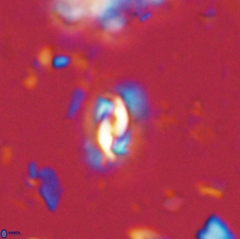 Prinsius diplopora 53815