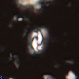 Prinsius diplopora 53816