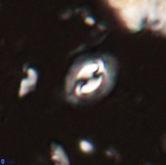 Prinsius diplopora 53817