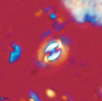 Prinsius diplopora 53818