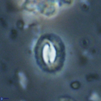 Prinsius diplopora 53824