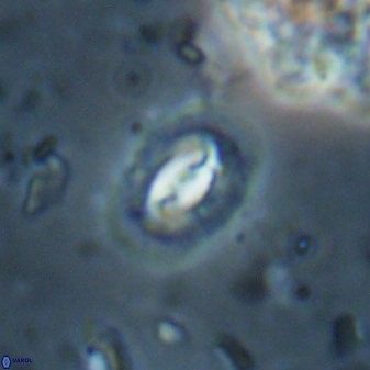 Prinsius diplopora 53827