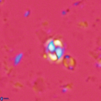Prinsius martinii 24076