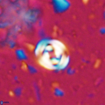 Pyrocyclus orangensis 27894